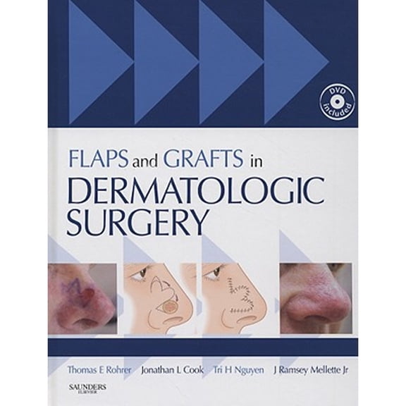 Pre-Owned Flaps and Grafts in Dermatologic Surgery: Text with DVD [With DVD] (Hardcover) 1416003169 9781416003168