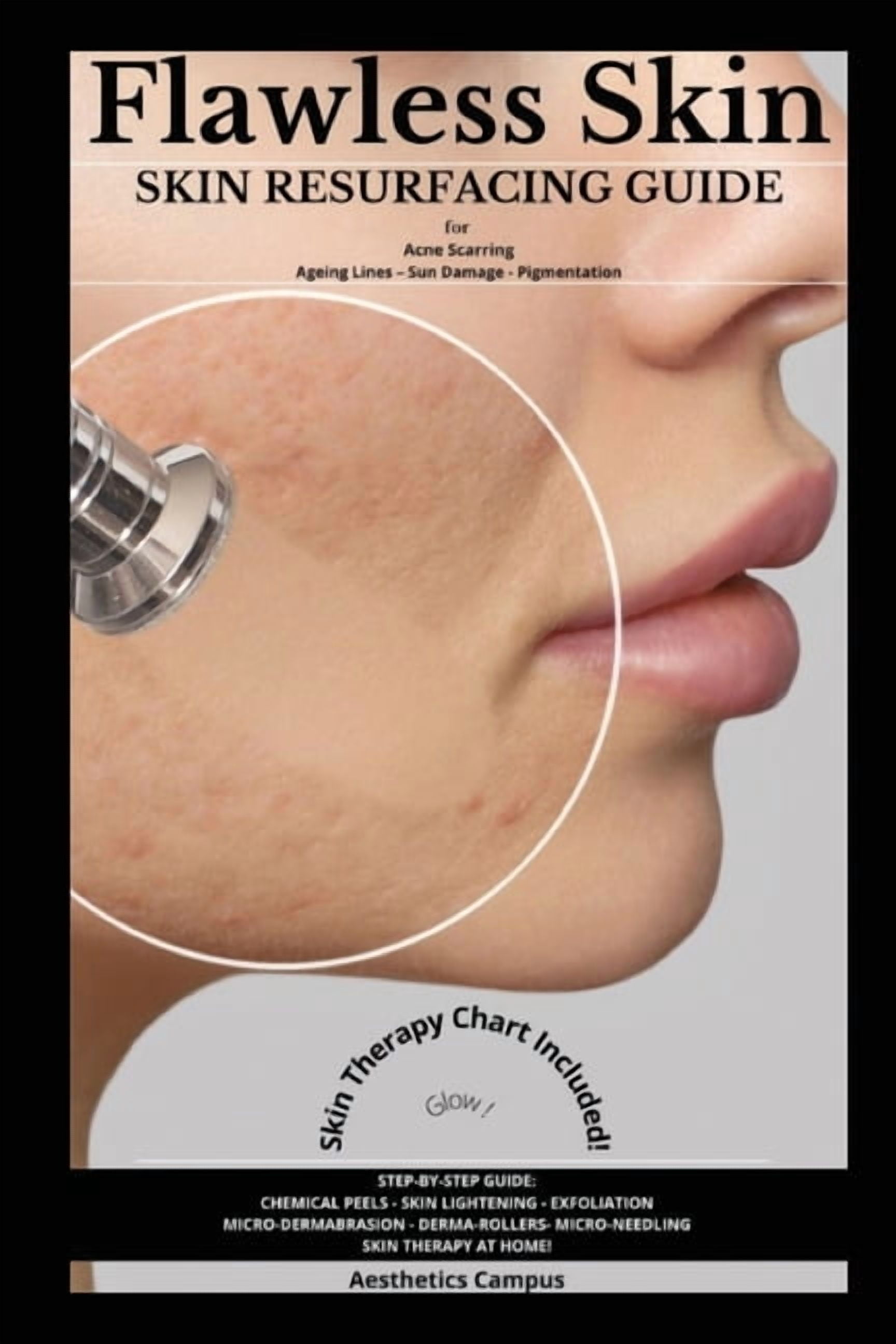 Flawless Skin: Skin Resurfacing Guide for Acne Scarring - Ageing Lines - Sun Damage - Pigmentation, (Paperback)