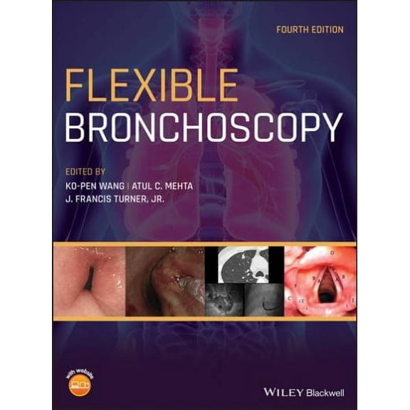 Flexible Bronchoscopy (Hardcover)