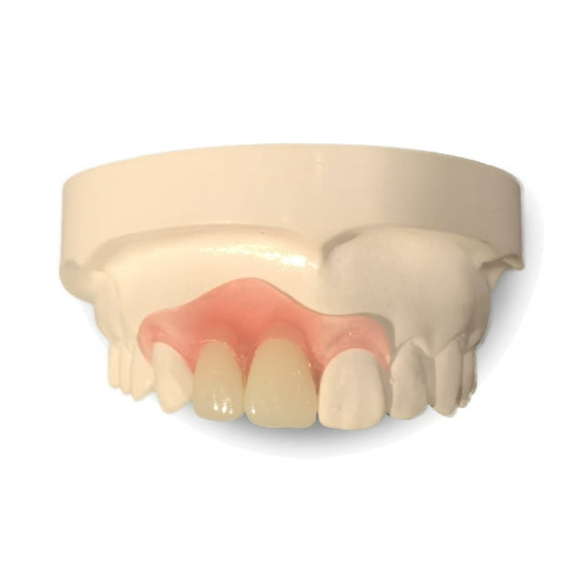 Flipper Partial Denture
