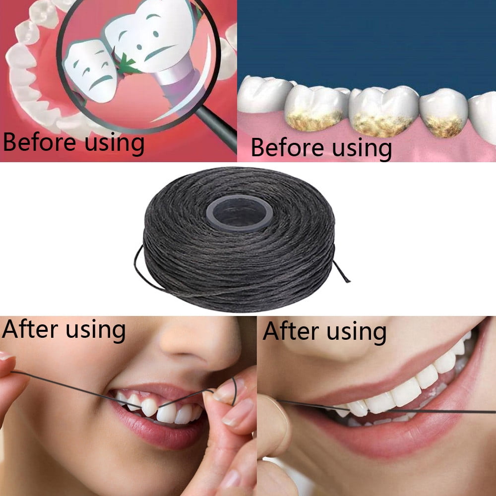 Flossing The Dirt Between The Teeth Removing Stains And Eliminating Bad
