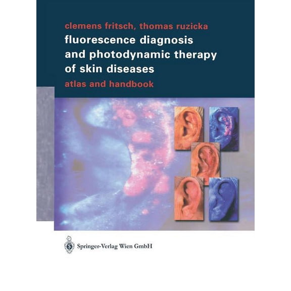 Fluorescence Diagnosis and Photodynamic Therapy of Skin Diseases: Atlas and Handbook, (Paperback)