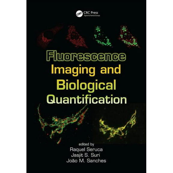 Fluorescence Imaging and Biological Quantification, (Hardcover)