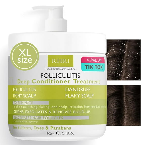 Folliculitis Deep Conditioner | Effective Scalp Treatment for Seborrheic Dermatitis, Psoriasis, Dry Itchy Scalp