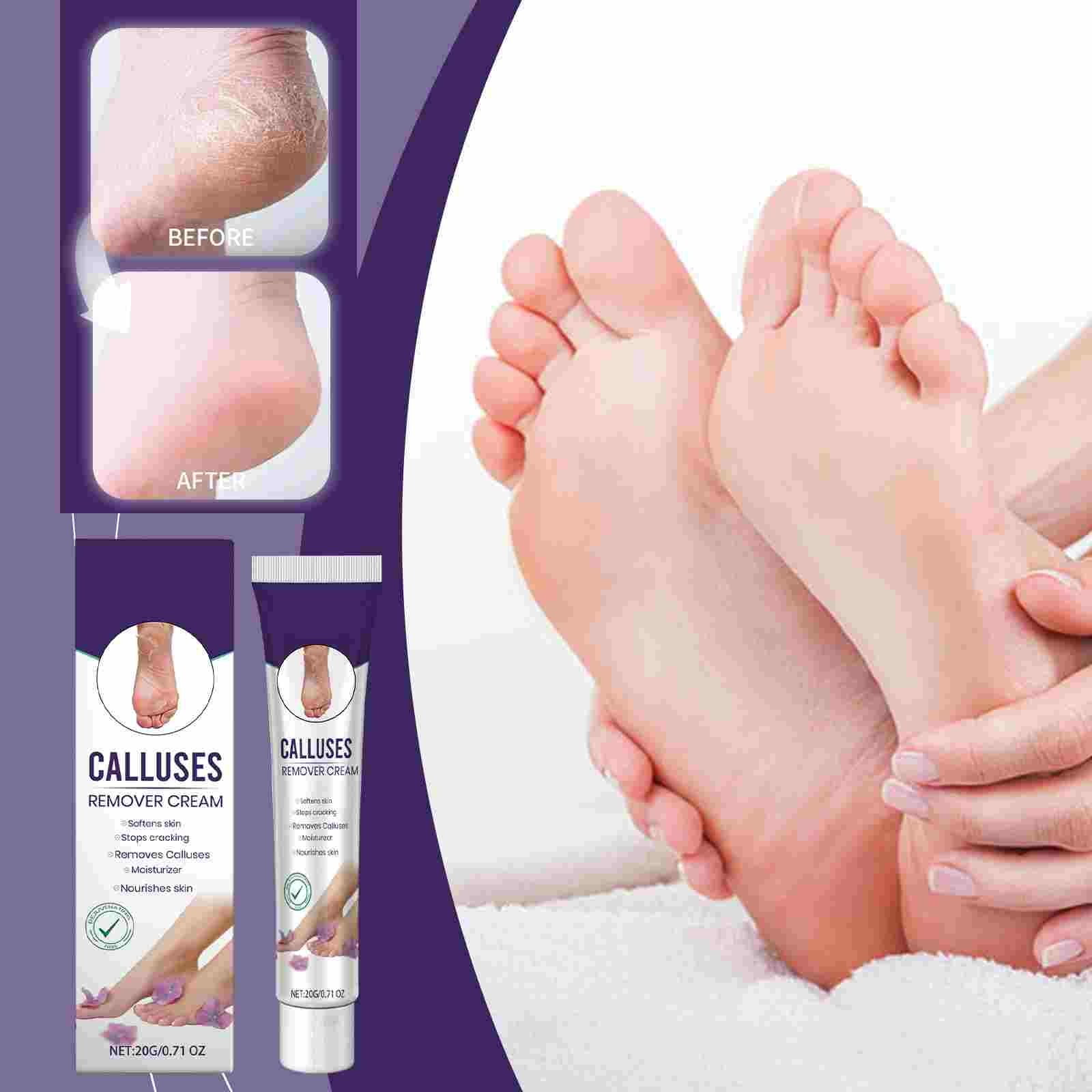 Foot Care Ointment That Moisturizes Dry And Cracked Feet, Quickly
