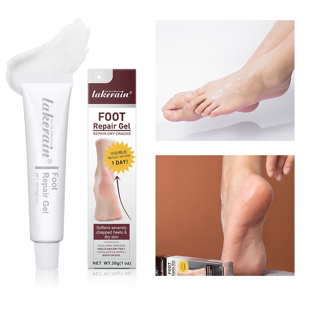 Foot Cracking Cream And Winter Heel Dry Cracking Moisturizing And