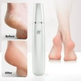 thumbnail image 1 of Foot File Electric, Callus Remover Rechargeable, Portable Charging Foot File With Multiple Speeds And USB Port, Waterproof Electric Foot Grinder With Coarse And Fine Grinding Heads For Home Use, 1 of 7
