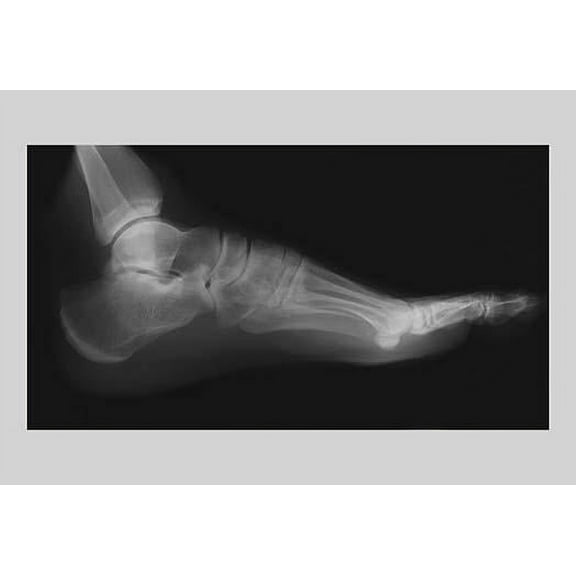 Foot-Fine Art Canvas Print (20" x 30")