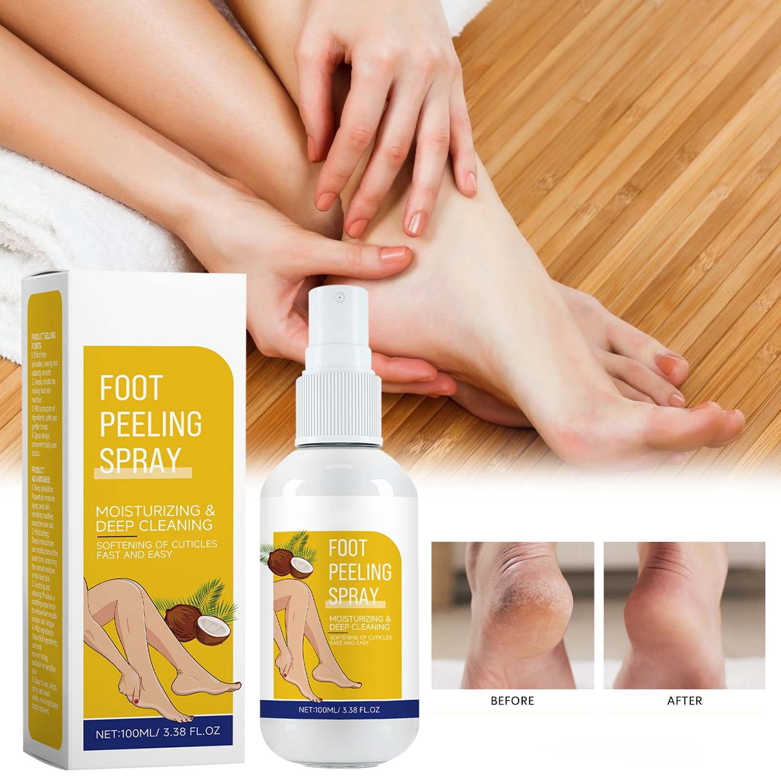 Foot Peeling Spray Coconut Foot Peeling Spray Instantly Dead Skin