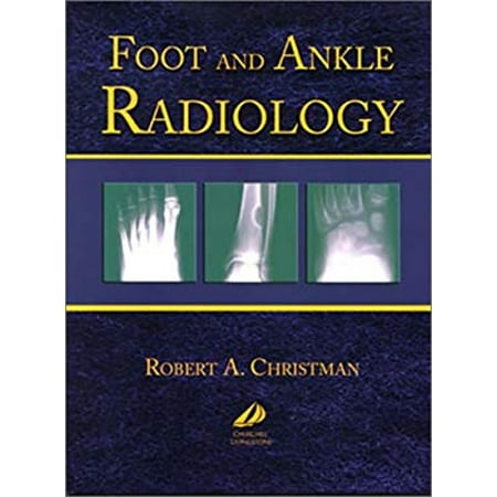 Foot and Ankle Radiology (Hardcover) 9780443087820
