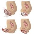 thumbnail image 1 of Four methods of female contraception Poster Print by TriFocal Communications/Stocktrek Images (16 x 16), 1 of 1