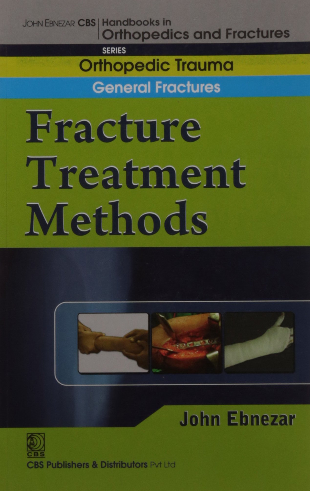 Fracture Treatment Methods (Handbook In Orthopedics And Fractures Vol
