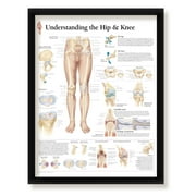 Framed Medical Poster Understanding The Hip and Knee 22x28 Wall Diagram Educational Informational Doctors Office Chart