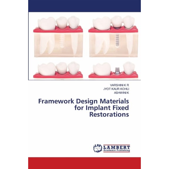 Framework Design Materials for Implant Fixed Restorations, (Paperback)