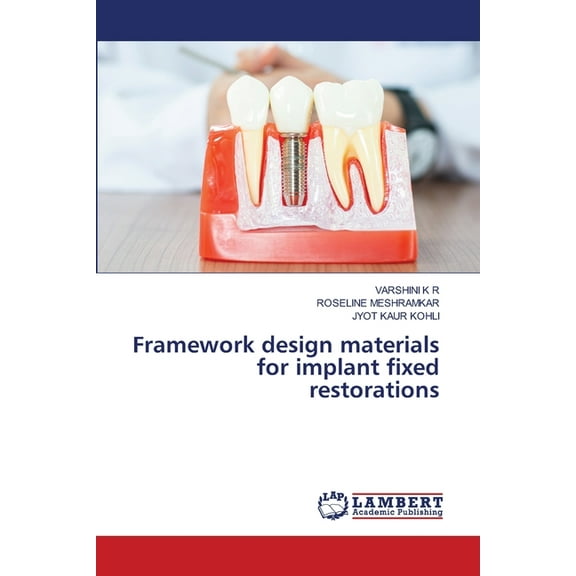 Framework design materials for implant fixed restorations, (Paperback)