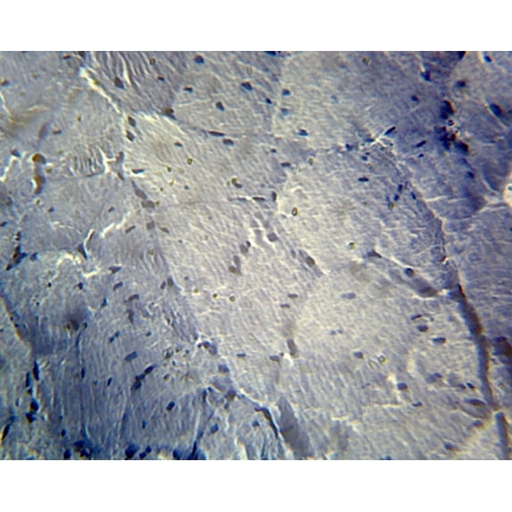 Frog Striated Skeletal Muscle; Cross Section by Go Science Crazy