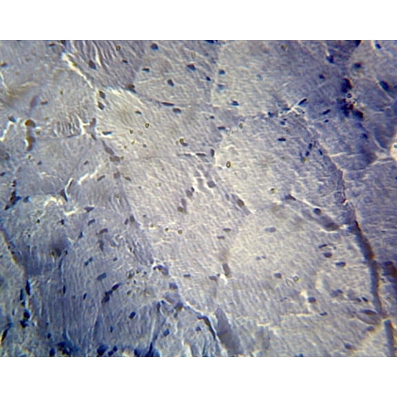 Frog Striated Skeletal Muscle; Cross Section by Go Science Crazy