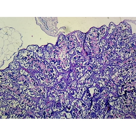 Frog Testis; Section; IH Stain by Go Science Crazy