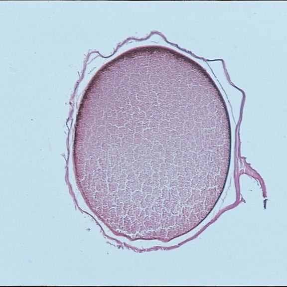 Frog Uncleaved Egg, Rep. Sag. Sec. 10 M, H&E Microscope Slide