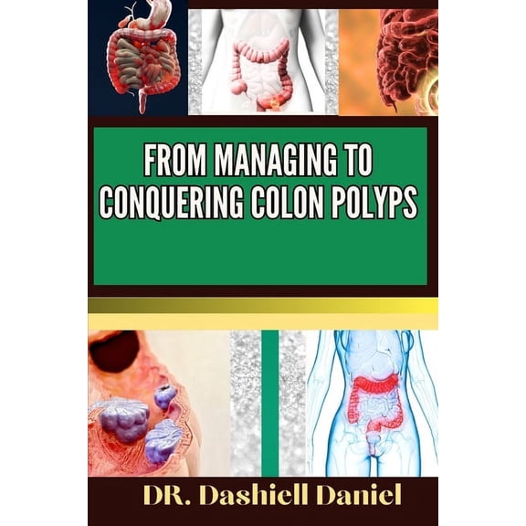From Managing to Conquering Colon Polyps: Expert Guide To Colon Polyps Causes, Symptoms, Treatment, And Achieving Comple, (Paperback)
