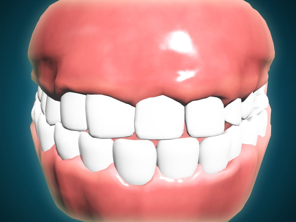 Front view of human mouth with teeth and gums Canvas Art - Stocktrek Images (33 x 25)