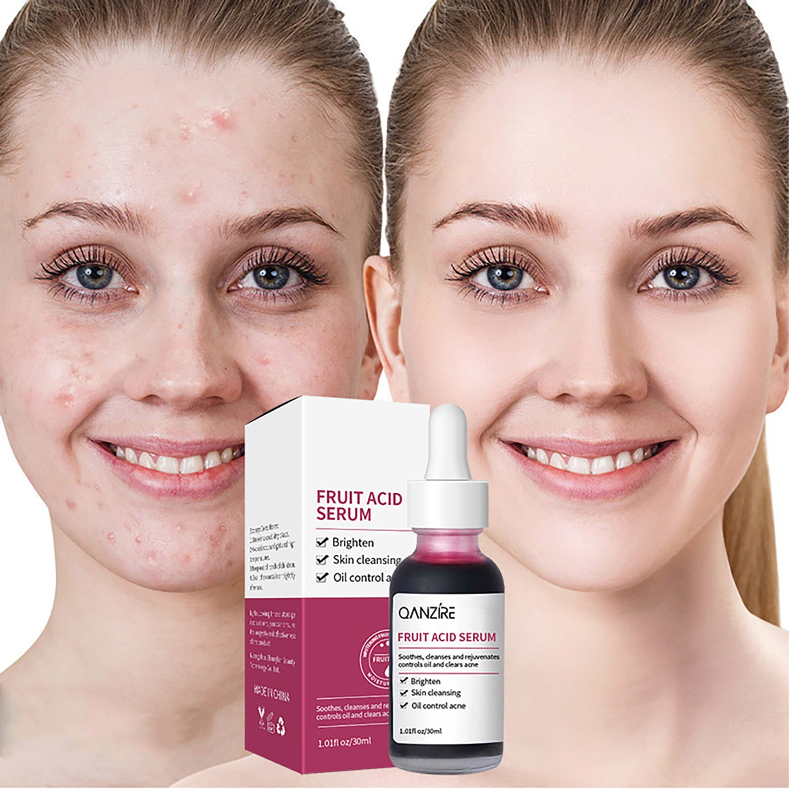 Fruit Solution Removing& Softening Keratinic 30ml Soaked in Melanin