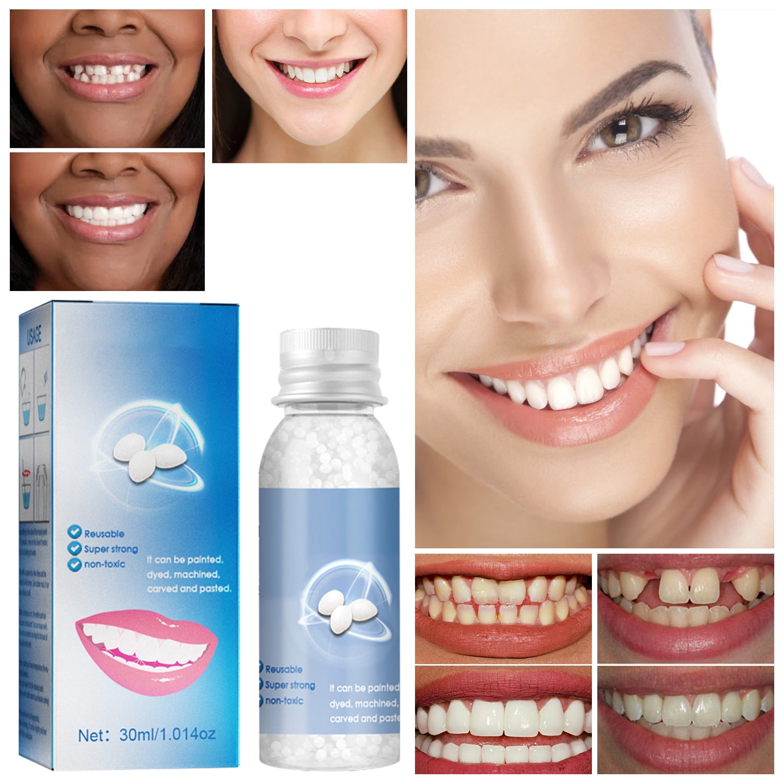 Frusde 1pcs Moldable False Teeth Tooth Repair Granules, Teeth Repair