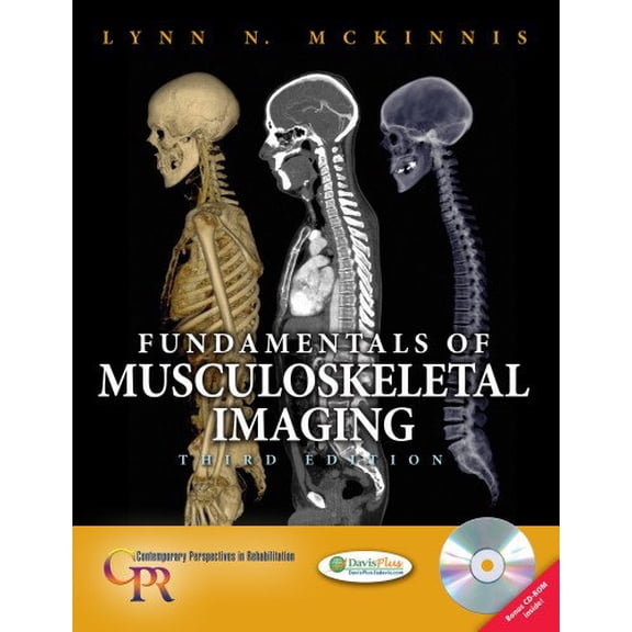 Pre-Owned Fundamentals of Musculoskeletal Imaging (Contemporary Perspectives in Rehabilitation) (Hardcover) 0803619464 9780803619463