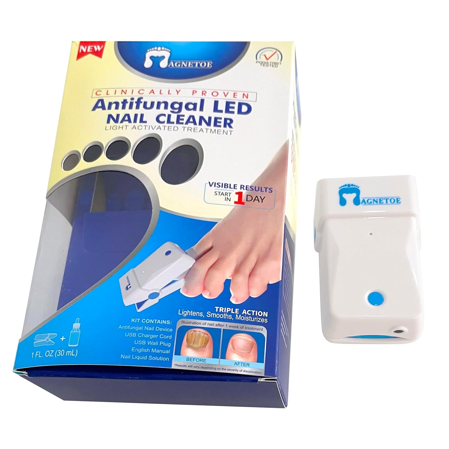 Fungal Nail Treatment Remove Discoloration and Fungus with LED Light