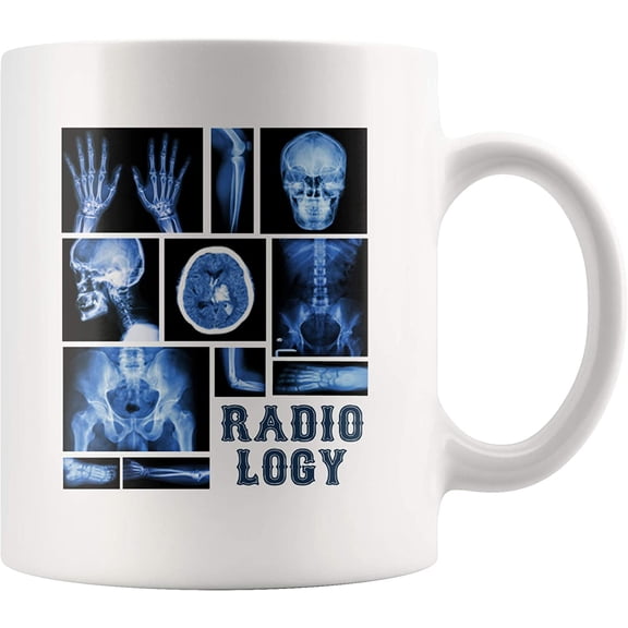 Funny Radiology X-Ray Tech Radiologist Science Themed Mug Human Skeletal System Anatomy For Students Teachers Novelty Drinkware Ceramic Coffee Tea Cup 11 oz White