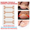 thumbnail image 1 of Fyydes  Bandage,24pcs Ingrown Toenail Correction Bandage  Paronychia Treatment Band Sticker,Ingrown Toenail Correction Bandage, 1 of 8
