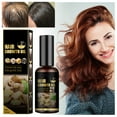 GARENAS Anti Falling Hair Spray Anti Hair Loss Hair Liquid Hair Growth