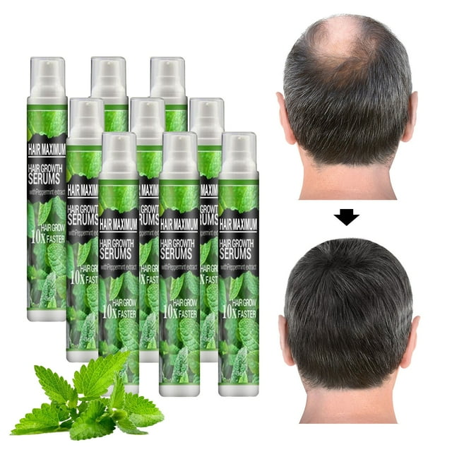 GARENAS Hair Regeneration Herbal Spray, Herb Growth Essences Spray