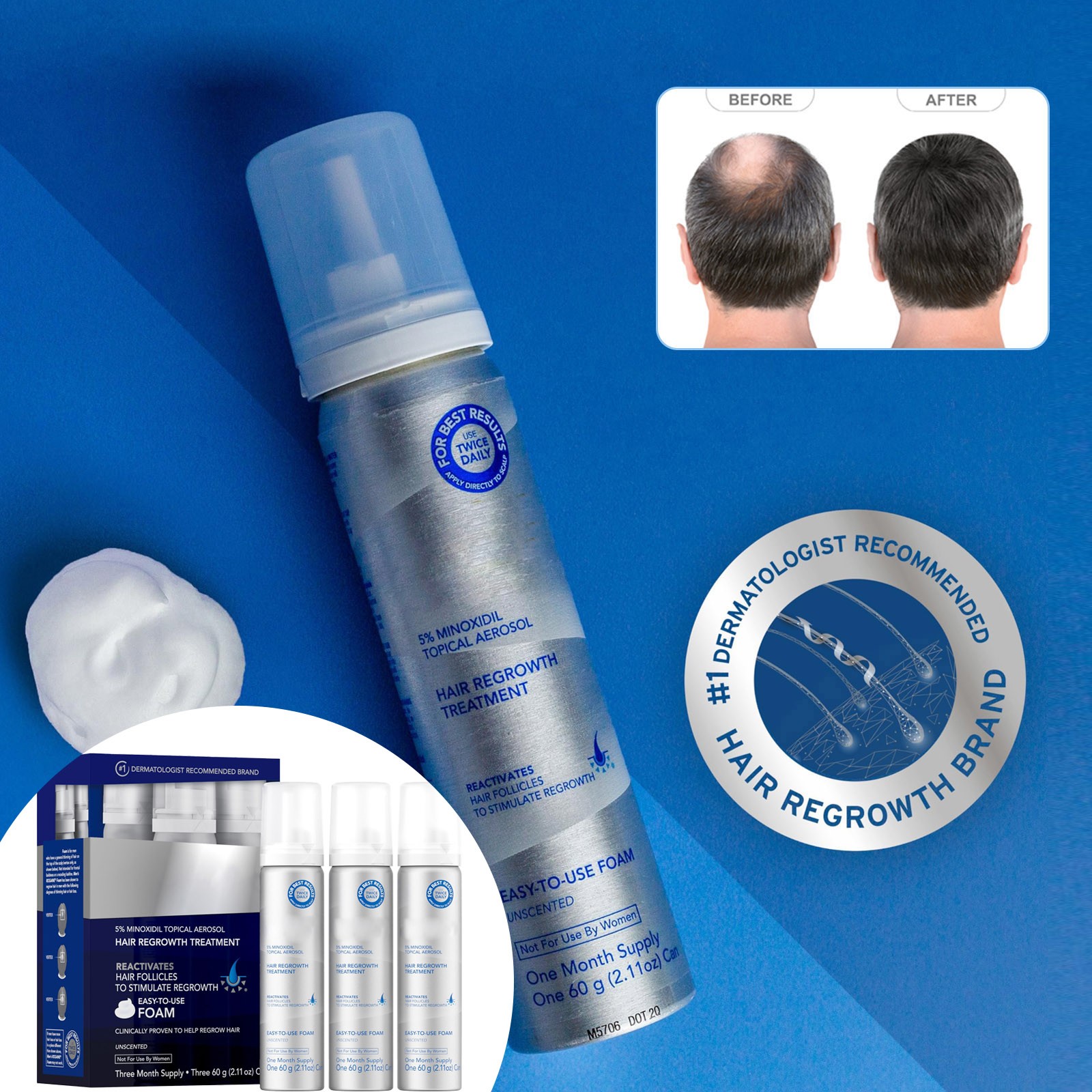 GARENAS Men's Hair Spray Targeted Care for Balding & Thinning Hair 3