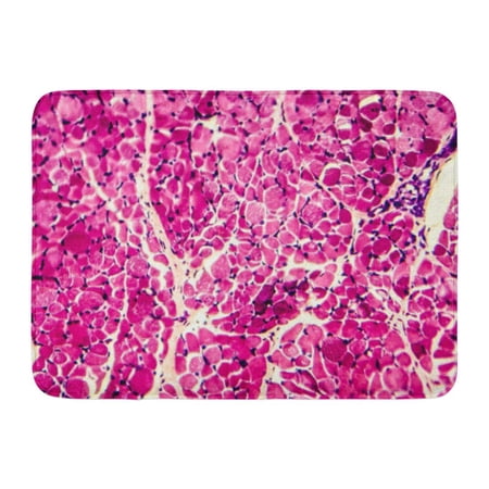 GODPOK Cell Science Cross Section of Skeletal Muscle Under Microscope Biology Eosin Rug Doormat Bath Mat 23.6x15.7 inch