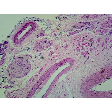 Medium-Sized Artery and Vein, Human; Cross Section by Go Science Crazy
