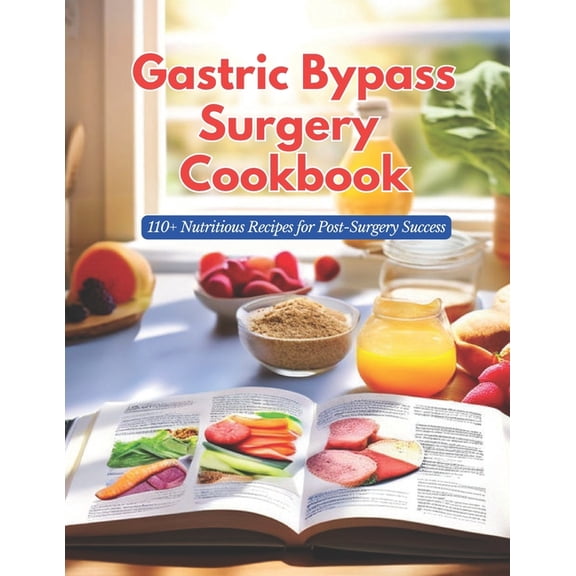 Gastric Bypass Surgery Cookbook: 110+ Nutritious Recipes for Post-Surgery Success, (Paperback)