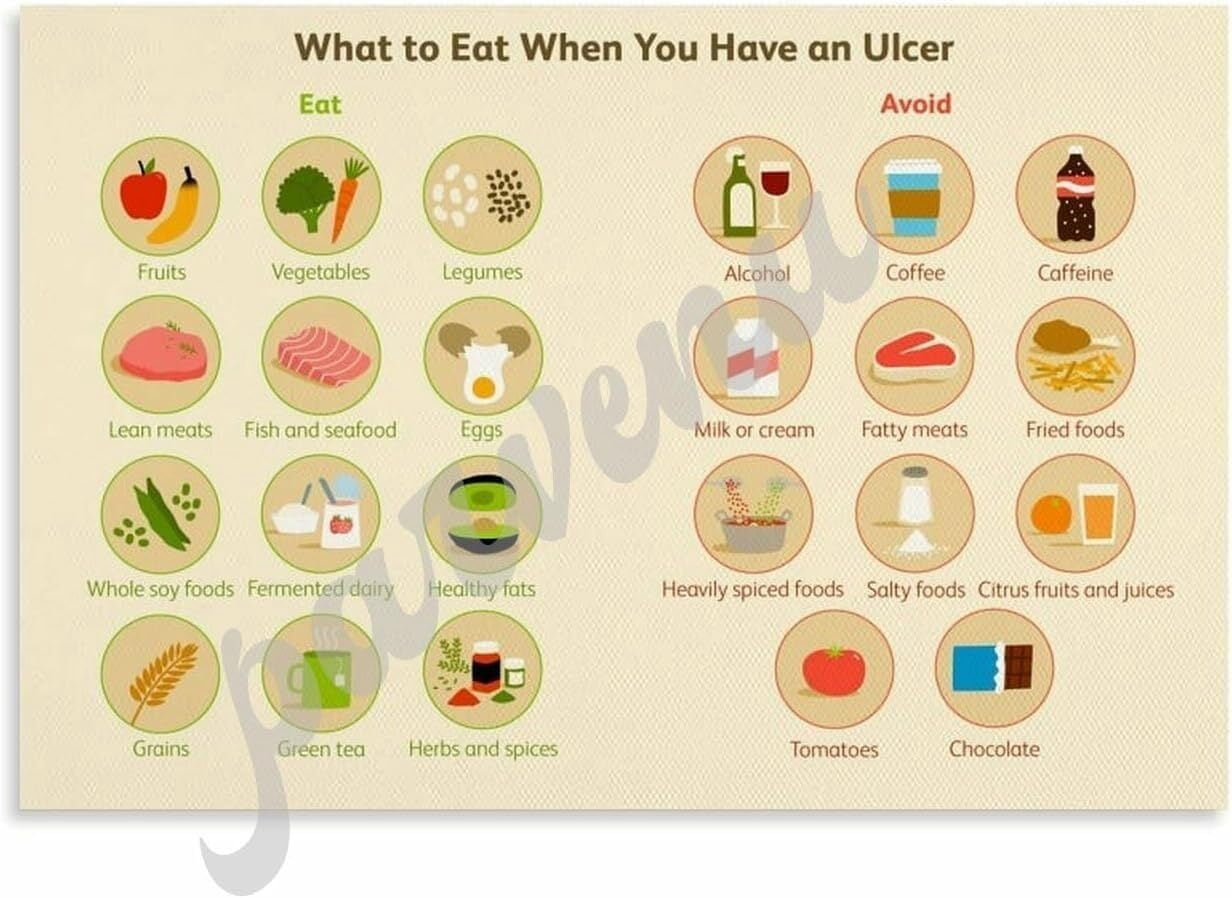 Gastric Ulcer Diet Should Eat And Avoid Food Guide Poster Stomach Ulcer Healthy Eating Recipe ...