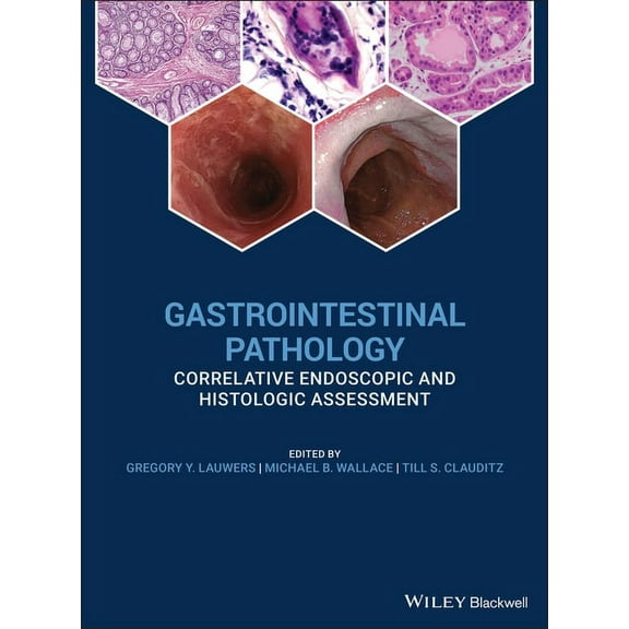 Gastrointestinal Pathology: Correlative Endoscopic and Histologic Assessment, (Hardcover)