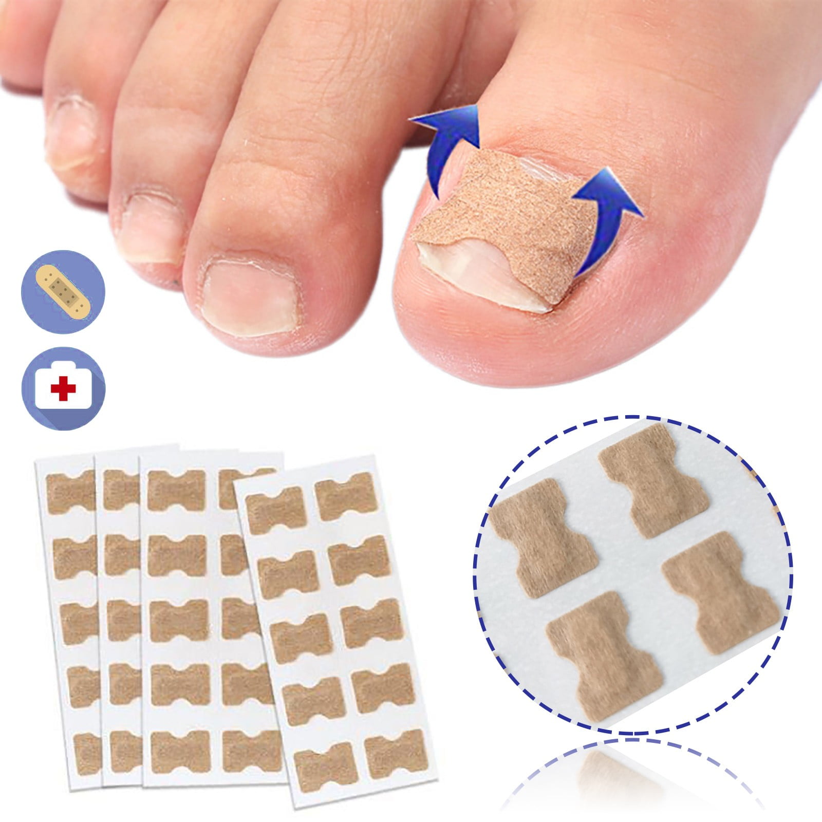 Gasuee Glue-Free Orthopedic Patch For Toe Nail Ingrown Toenail ...