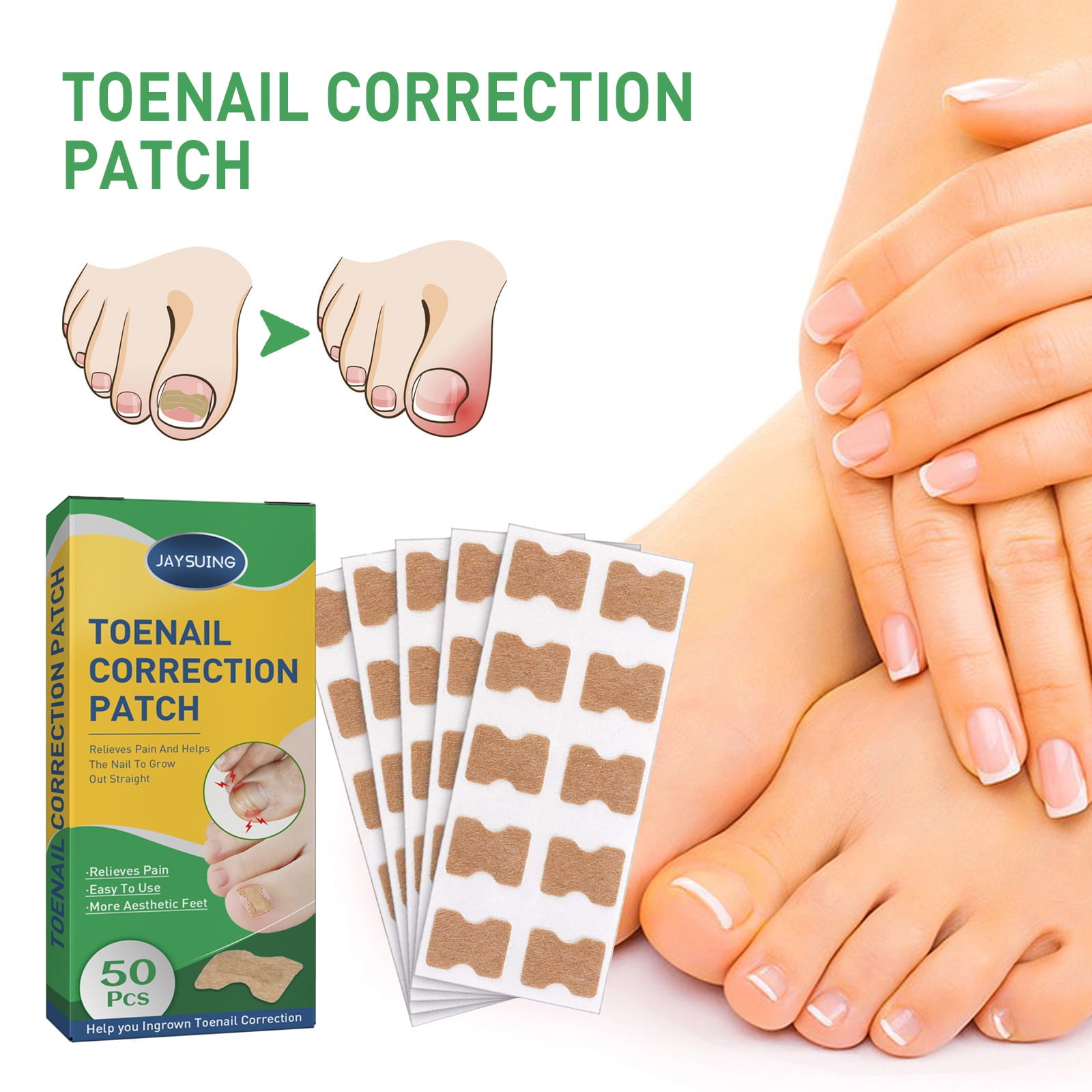 Gasuee Ingrown Toenail Correction Stickers, Gluefree Ingrown Toenail