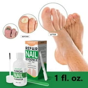 Genkent Fungi Nail Anti-Fungal Oil, Nail Fungus Treatment for Toenail Extra Strength, Antifungal Solution and Fungal Nail Cure Under the Nail, Toe Fingernail Repair for Damaged Discolored Thick Nails