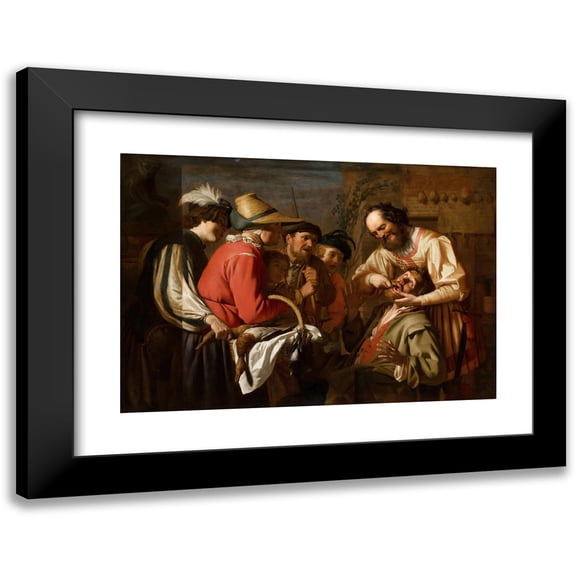 Gerrit van Honthorst 14x11 Black Modern Framed Museum Art Print Titled - The Tooth Puller (1628)