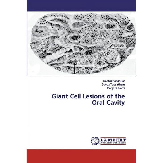 Giant Cell Lesions of the Oral Cavity (Paperback)