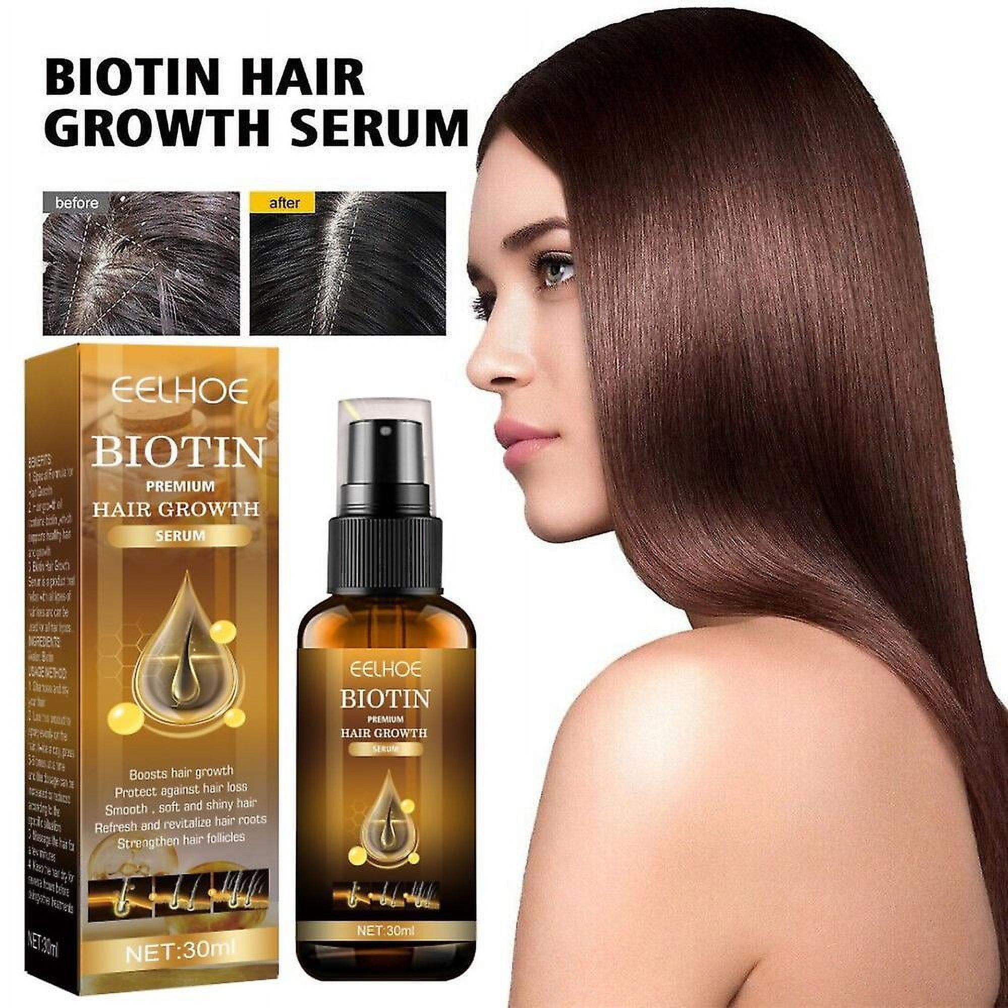 Ginger Hair Fast Growth Serum Spray Biotin Anti Hair Loss Prevent