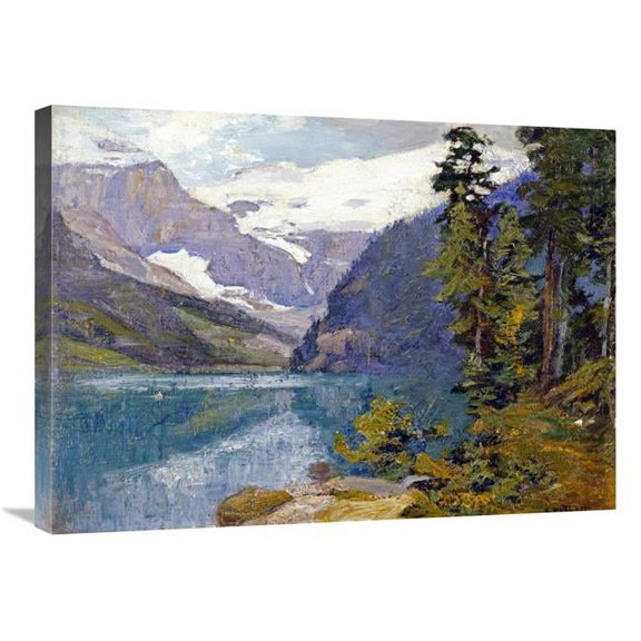 Global Gallery Lake Louise - British Columbia Art Print - Edward Henry Potthast
