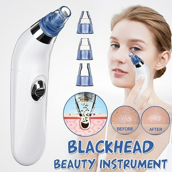 Gnmfd Portable Blackhead Pore Cleaner Vacuum Suction Beauty Instrument with 4 Interchangeable Heads, Facial Skin Exfoliation Blackhead Remover for Home Spa Facial Treatment Skincare