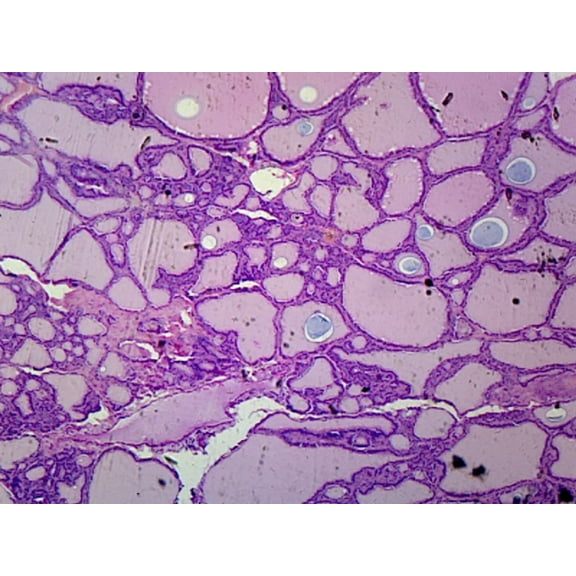 Goiter (Human Endocrine System); Section; H&E Stain by Go Science Crazy