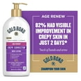 Gold Bond Age Renew Crepe Corrector Hand, Face and Body Lotion Cream