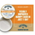 Gold Bond Rough And Bumpy Keratosis Pilaris Gold Bond Rough & Bumpy Hand and Body Lotion & Cream for Extra Dry Skin